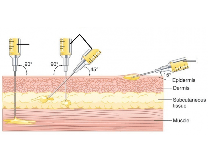 Label the types of injections — Printable Worksheet