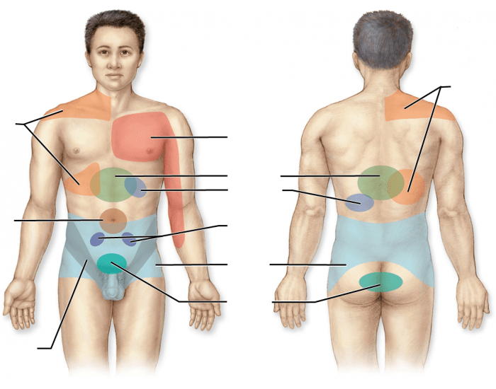 Common Patterns of Referred Visceral Pain Quiz