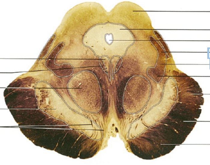 Midbrain Labels Midbrain labels Quiz