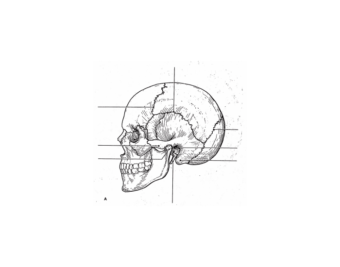 The Skull Quiz