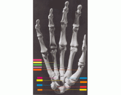 Bones of the Wrist and Hand