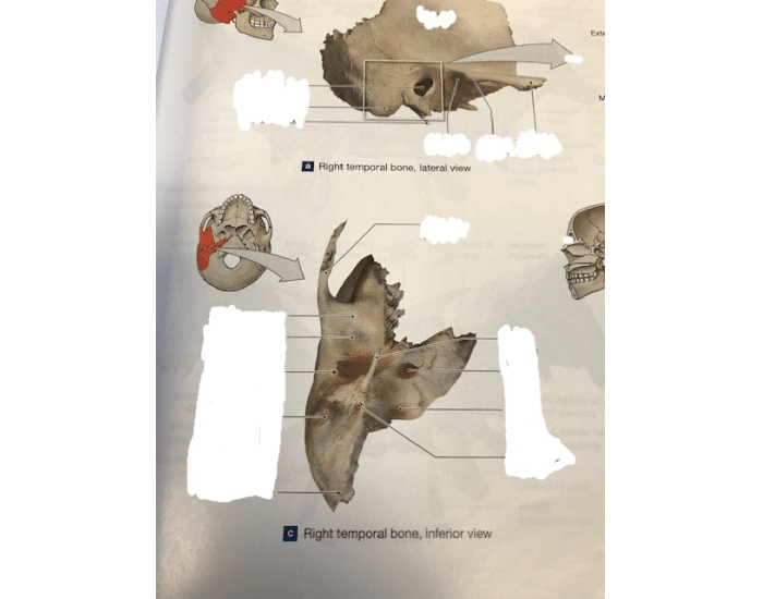 Inferior view of Temporal bone Quiz