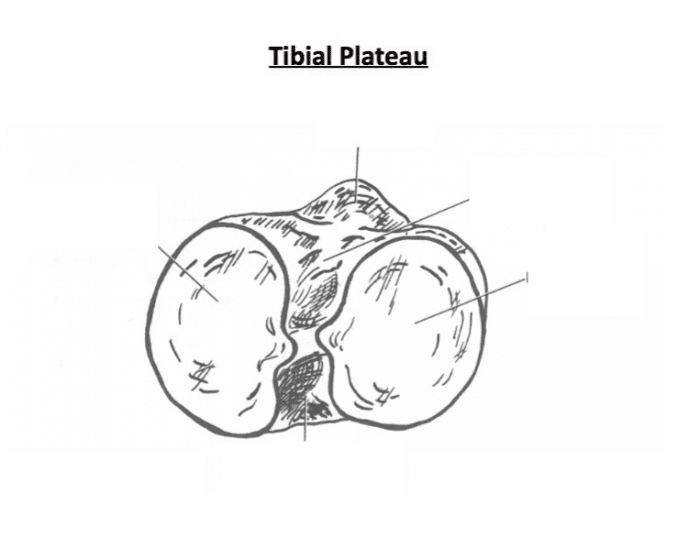 Tibial Plateau — Printable Worksheet
