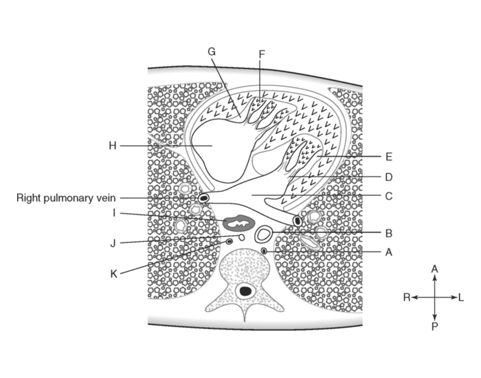 Cross Sectional Anatomy Quiz Biology Diagrams