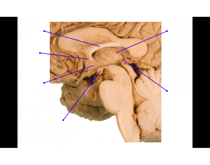 Stem View brain stem view Quiz
