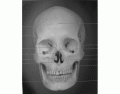 anterior skull
