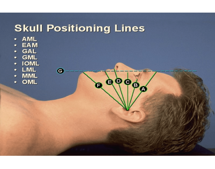 Skull Positioning Lines RAD — Printable Worksheet