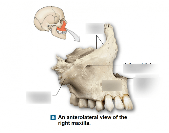 Maxilla Labeling Maxilla Labeling Quiz