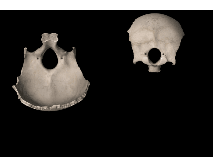 Oc Bone Pattern Occipital Bone Markings — Printable Worksheet