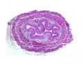 Histology of esophagus
