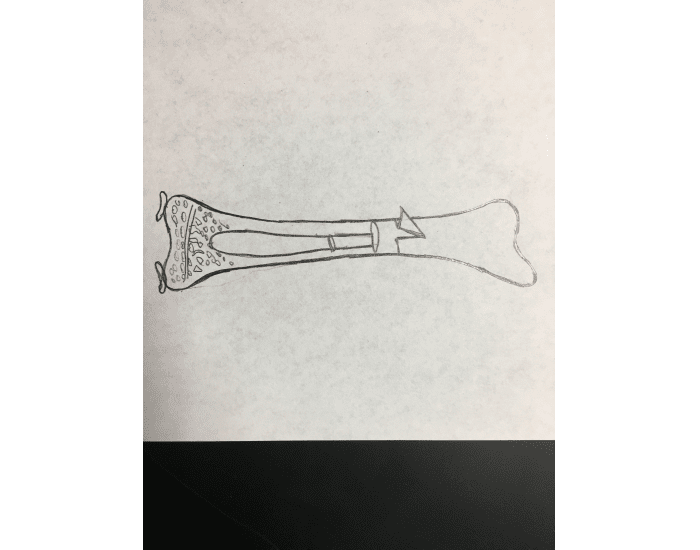 Long Bones Labeling Quiz