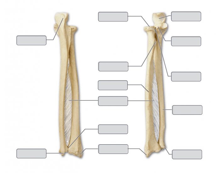 radius and ulna labeling Quiz