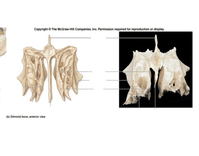 Ethmoid Bone Landmarks Printable Worksheet