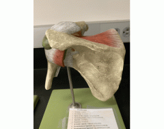 Anterior View of Shoulder Joint