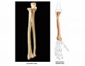 Human Forearm Bones Anatomy Quiz