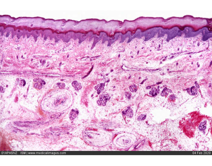 Integumet Under Microscope Photomicrograph of Integument — Printable Worksheet