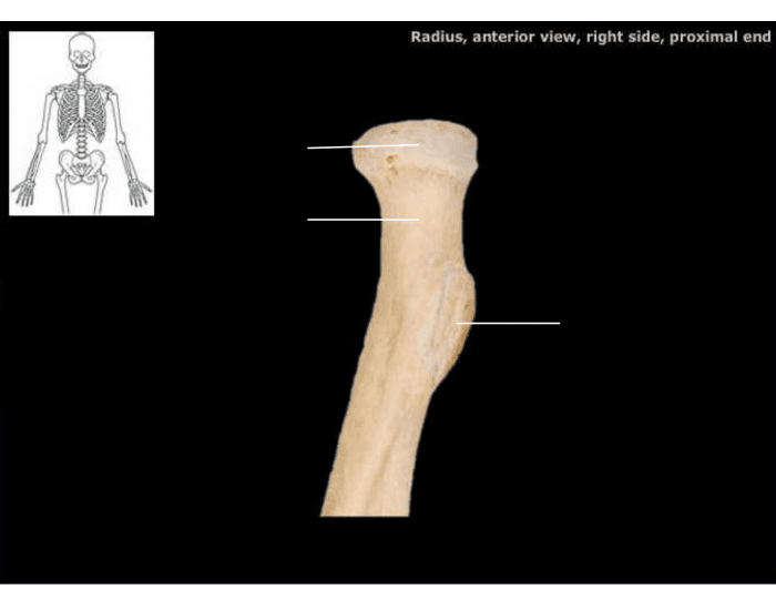 Radius anterior view right side proximal end Quiz