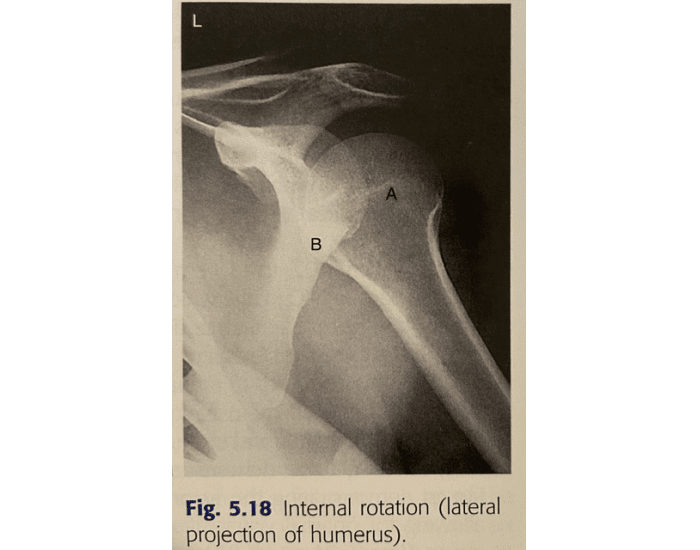 internal rotation (lateral of humerus) Quiz