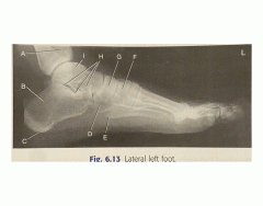 lateral left foot xray