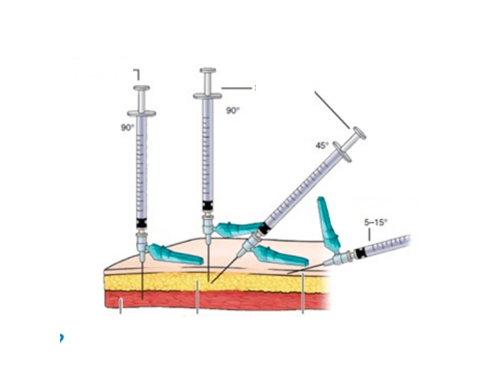Injections Quiz