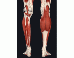 Anatomia aplicada da coxa- Músculos Quiz