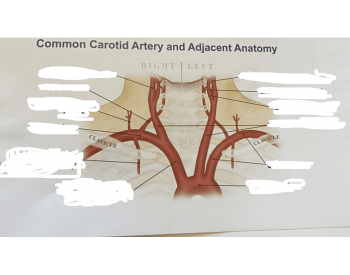 Common Carotid Artery And Adjacent Anatomy Printable Worksheet common-carotid-artery-and-adjacent-anatomy-printable-worksheet
