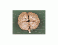 vista posterior del cerebro