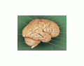 cerebro vista lateral