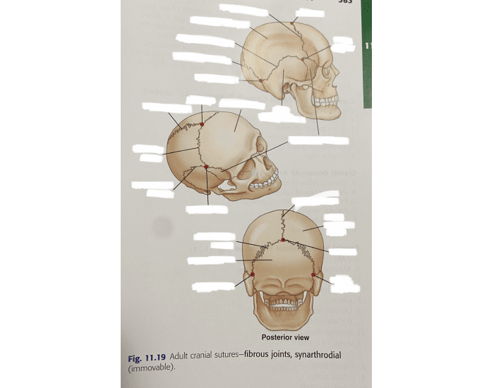 Adult Cranial Sutures Quiz 0200