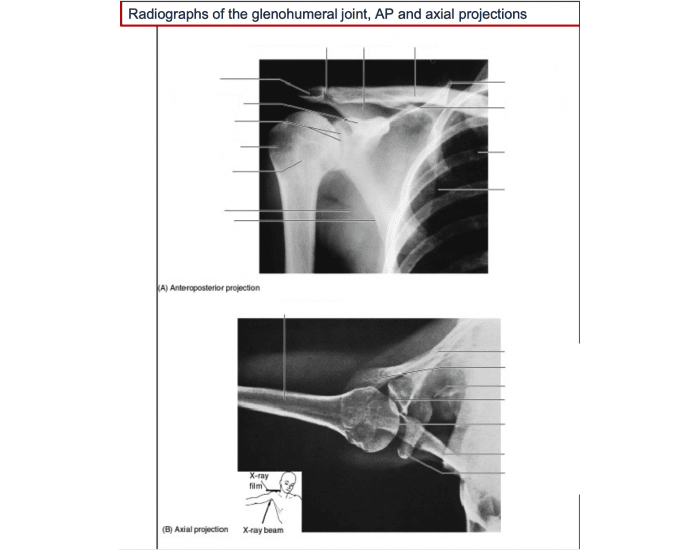 Shoulder radiograph Quiz