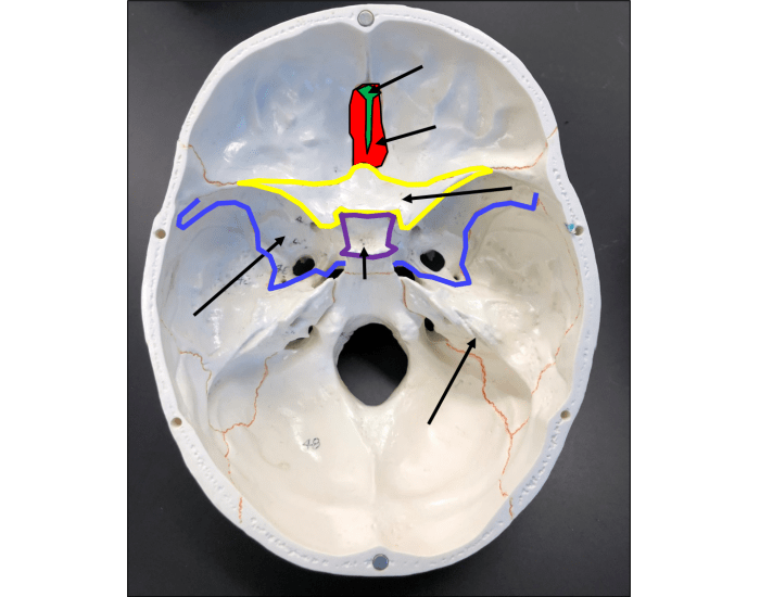 Bone Innerview skull internal view: bone markings Quiz