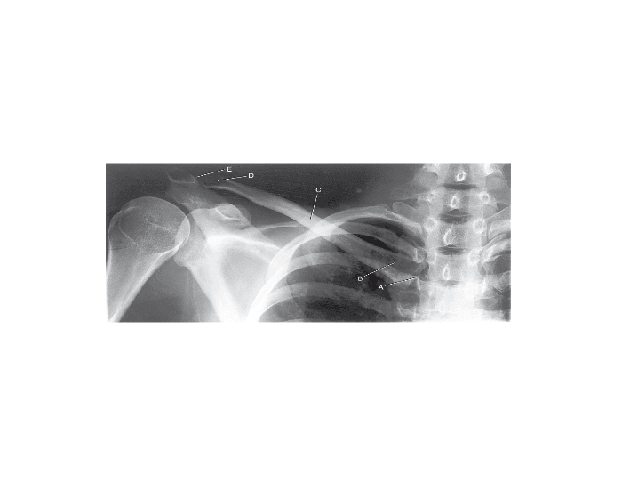 Shoulder Anatomy Quiz