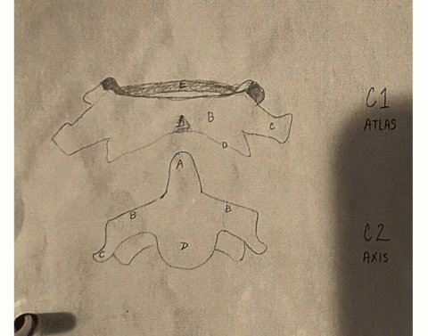 Tangential patella/ settegast method — Printable Worksheet