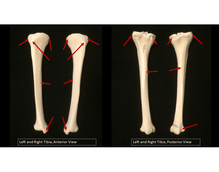 Left and Right Tibia, Anterior and Posterior View Quiz