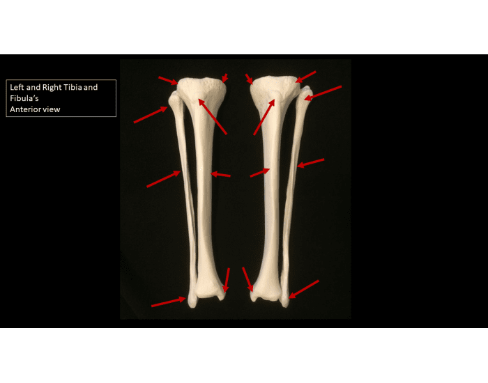 Left and Right Tibia and Fibula's Anterior View — Printable Worksheet