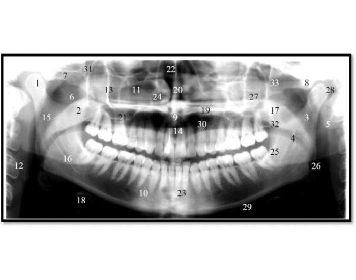 Panoramic Radiograph Label Panoramic Radiograph Identification — Printable Worksheet
