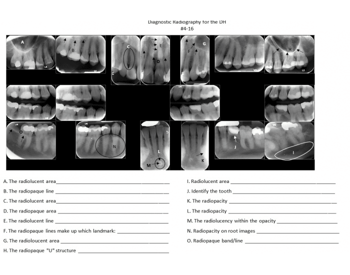 FMS Radiographic Anatomy Quiz
