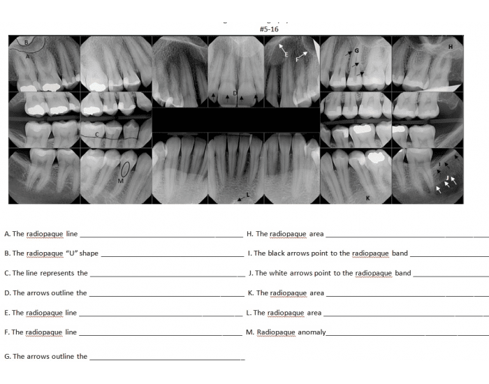 FMS Radiographic Anatomy 5-16 Quiz