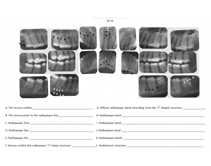 FMS Radiographic Anatomy Quiz