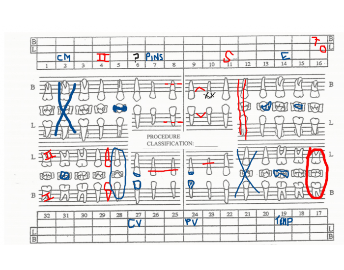 Dental Charting Quiz Dental charting quiz