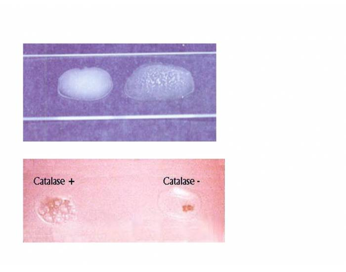 micro bio lab - sg catalase test questions flashcards... MCB2010 - Catalase Test Quiz