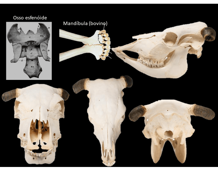 Map Quiz: Mandibula (imesap - mandibula - huesos)