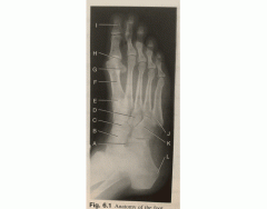 AP medial oblique right foot