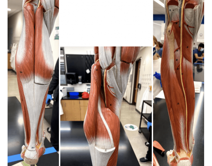 Lower Leg Quiz