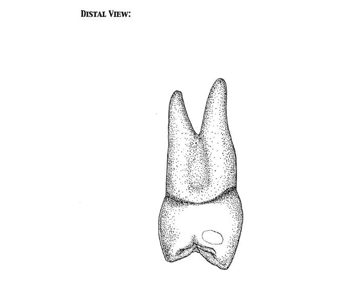 Maxillary Right First Premolar Distal View Quiz