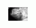 Radiografia da mandíbula - axiolateral oblíqua