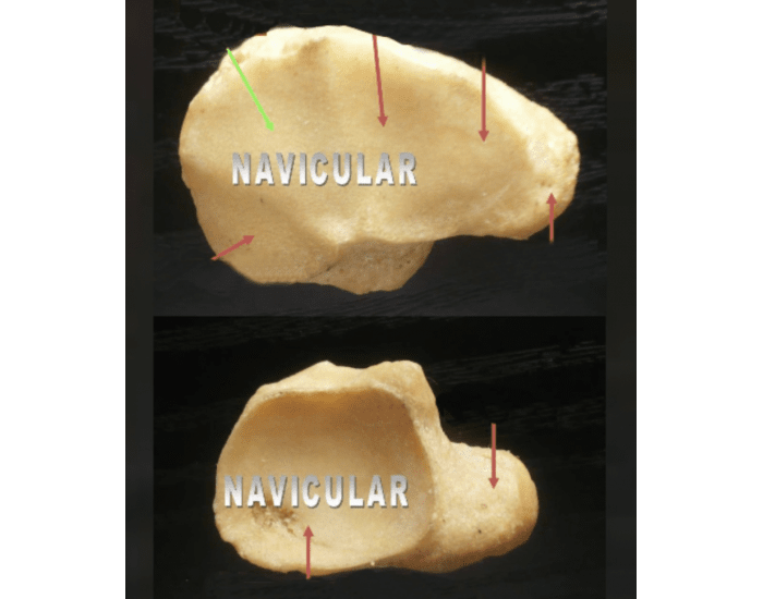 Navicular anatomy — Printable Worksheet