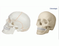 Cranio - generalidades 1