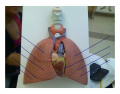 Identify the structures of the lungs