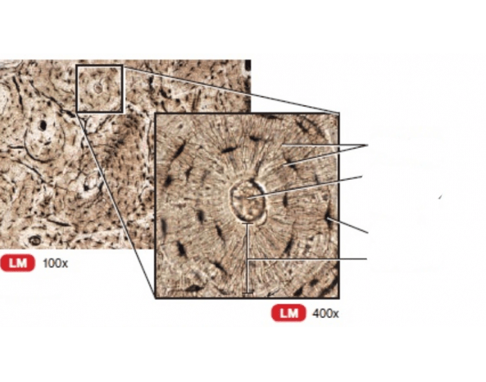 Bone Tissue Zoomed In compact bone tissue zoom Quiz